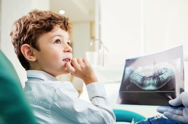 Dental x-rays kids